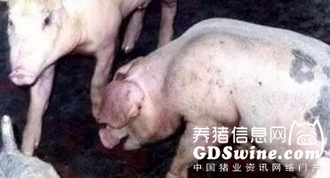 3支原体肺炎